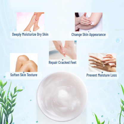 OUKEYA 40 Percent Urea Cream Hand Foot Cream for Dry Cracked Skin | Intensive moisturising urea lotion, softens rough dry cracked skin on hands, heels and feet